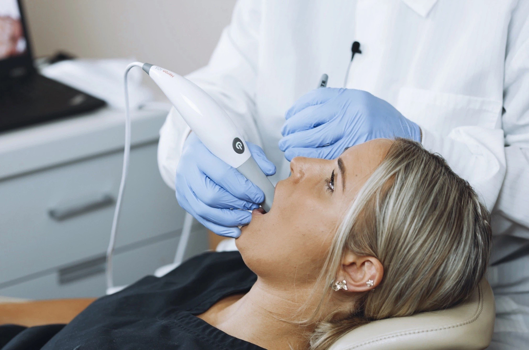 Intraoral Scanner Intraoral Scanner